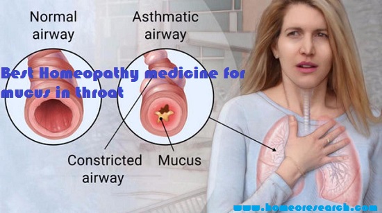 best homeopathy medicine for mucus in throat