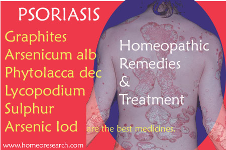 Psoriasis Permanent Treatment