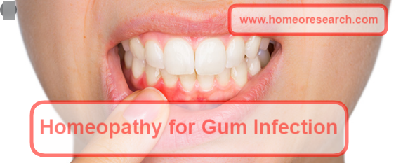 Homeopathy medicine for gum infection 