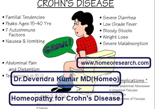homeopathic-medicines-for-crohns-disease