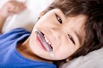 Homeopathy Remedy for grinding teeth