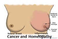Homeopathic remedies for cancer