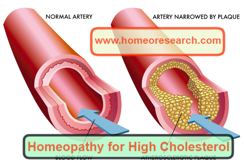 is homeopathy good for cholesterol
