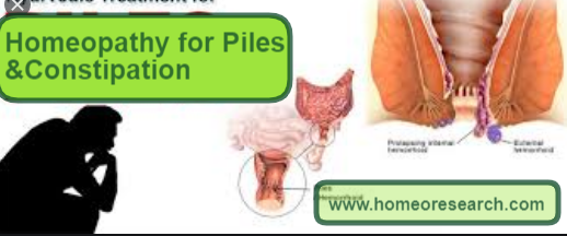 Homeopathic medicine for Constipation and Piles