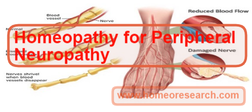 Peripheral Neuropathy treatment in Homeopathy